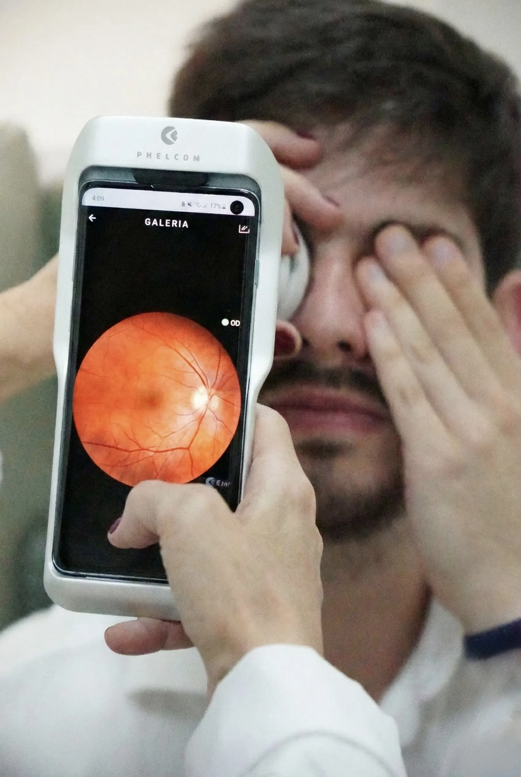 Mapeamento de retina com tecnologia Phelcom para diagnóstico oftalmológico preciso